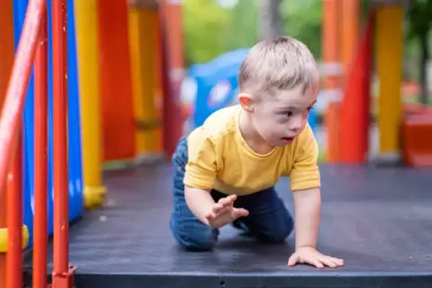 Criança com Síndrome de Down a explorar num parque infantil